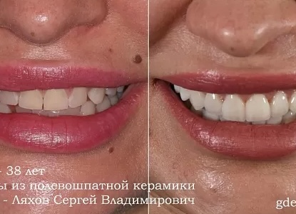 ХУДОЖЕСТВЕННЫЕ МАТЕРИАЛЫ. СЭКОНОМИТЬ ИЛИ ЛУЧШЕ НЕ СТОИТ?